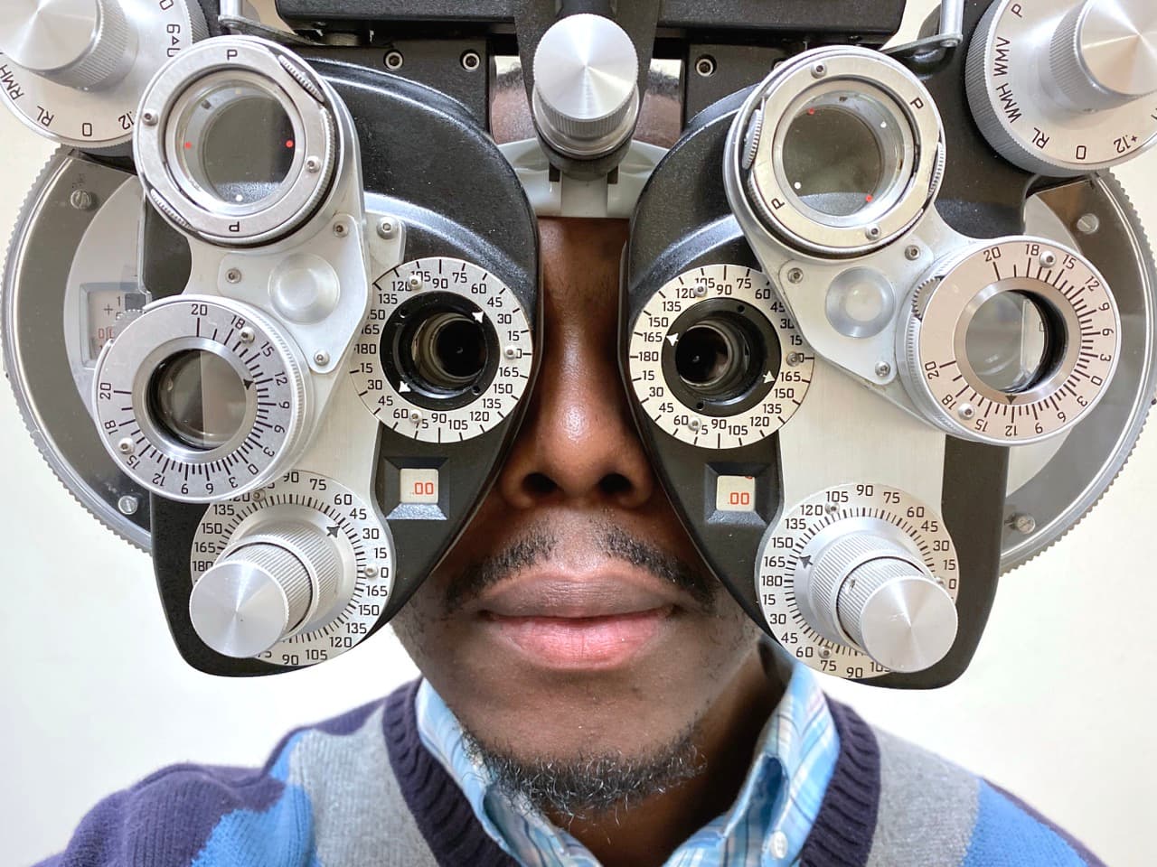 A tight, head-on point-of-view shot looking through an optometry phoropter at a man's face mid eye exam. The instrument's twin dialed lenses and printed scales frame his eyes, filling most of the frame. A clinical, instantly-recognizable medical-device image of the kind almost no one has in their portfolio.